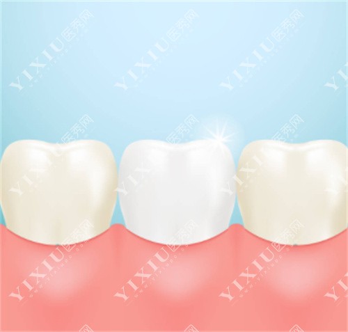牙齿美白<span style=