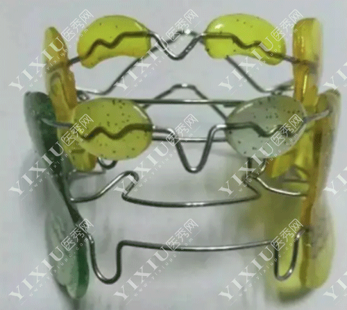 下颌骨十个做了九个后悔？正颌手术问题集锦一文看懂不迷茫！(图5)