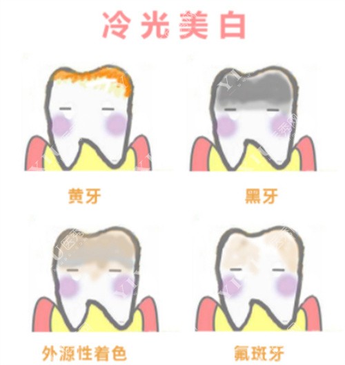冷光美白适应症