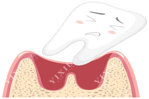 卡通牙齿松动示意图