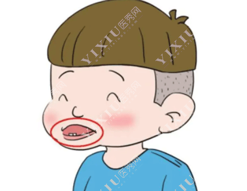 下颌骨十个做了九个后悔？正颌手术问题集锦一文看懂不迷茫！(图2)