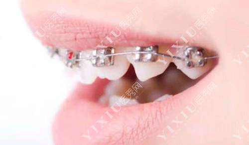 下颌骨十个做了九个后悔？正颌手术问题集锦一文看懂不迷茫！(图8)