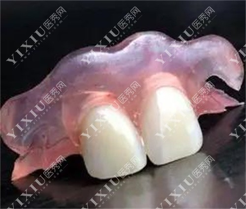 牙齿隐形假牙的图片