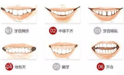 各类牙体错颌展示
