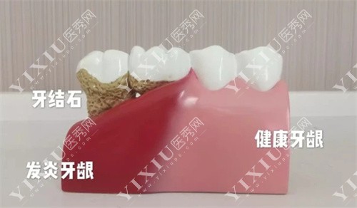 牙齿细节图