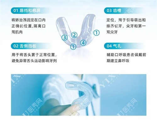 问北京做早期矫治多少钱？这有儿童早期矫治器罗慕／eta费用!(图6)