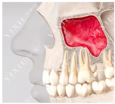 上颌窦位置图示