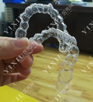 隐形牙套照片