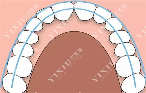 牙齿矫正动画图