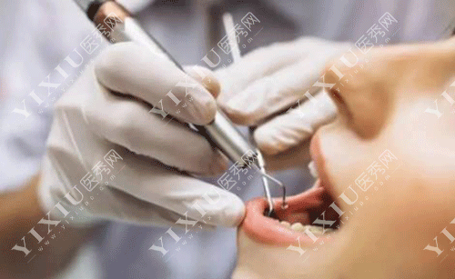 牙龈翻瓣术有必要做吗？做牙龈翻瓣手术后后悔了是啥原因？(图10)