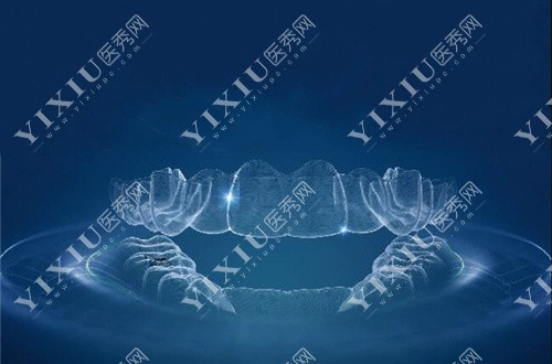 隐形矫治器示意图