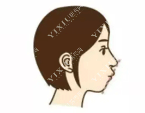 大学生23岁整牙之后后悔了！后悔的原因竟然是这个!(图4)