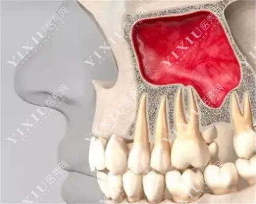 正常牙骨侧面图片图片