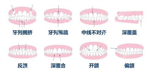 牙齿症状图