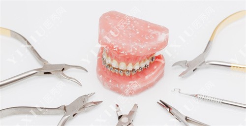 牙齿矫正工具模型图
