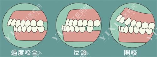 吉林市博菲特口腔牙齿矫正图