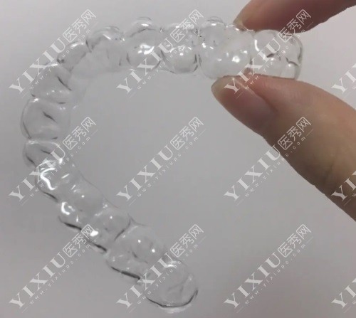 隐形牙套示意图
