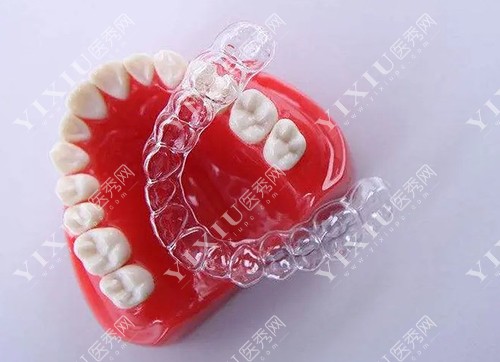 隐形牙套和牙齿模型