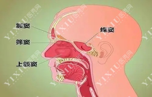 上颌窦位置解剖示意图