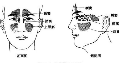 上颌窦位置正侧面示意图