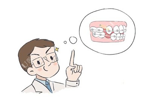 牙齿矫正收缝卡通示意图