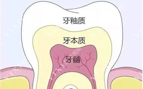 牙齿内部结构卡通示意图