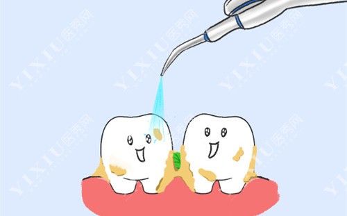 牙齿清洁中卡通图