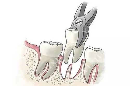 通化王明曲(王氏)口腔看牙种牙怎么样?技术好服务贴心~(图3) 通化王明曲(王氏)口腔看牙种牙怎么样?技术好服务贴心~(图3)