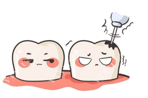 牙齿龋洞图片展示