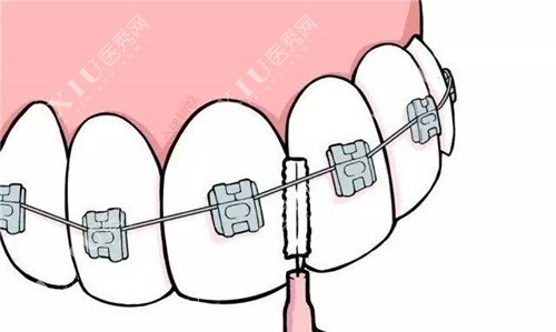 牙齿清洁卡通图