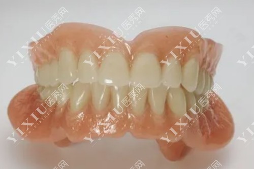全口活动假牙展示图