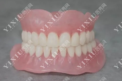 吸附性义齿图片展示