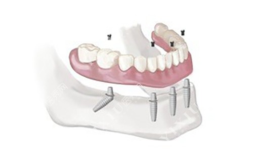 天水哪家口腔诊所正规靠谱?贝洁口腔看牙好还不贵可以一探~(图3) 天水哪家口腔诊所正规靠谱?贝洁口腔看牙好还不贵可以一探~(图3)