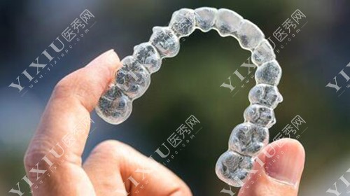 牙齿隐形正畸改善