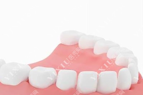 健康牙齿模型示意图