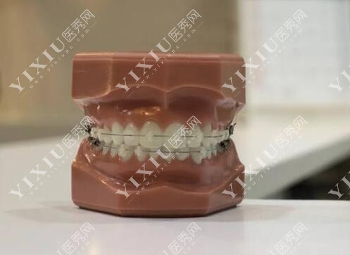 蚌埠牙科收费价目表更新，补牙／修复类项目价格超低！(图3)