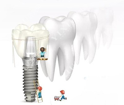 蚌埠牙科收费价目表更新，补牙／修复类项目价格超低！(图5)