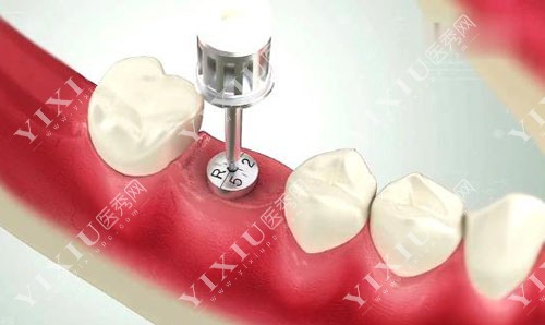 广西牙科预约24小时开诊，免费获取收费明细和牙科资料！(图3)