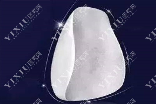 牙贴面卡通图