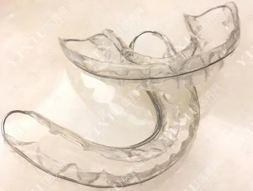 牙齿矫正保持器示意图