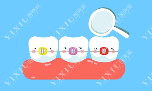 检看牙齿示意图