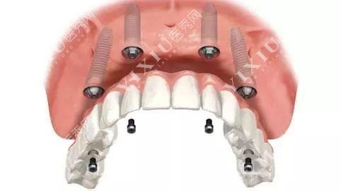 驻马店牙科价目表公布!选到正规靠谱牙科治牙也不贵哦~(图5) 驻马店牙科价目表公布!选到正规靠谱牙科治牙也不贵哦~(图5)
