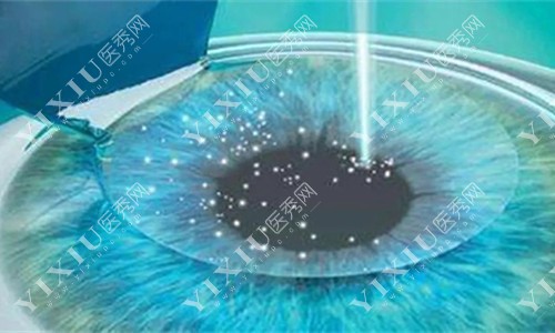 河北保定德仁眼科怎么样？高碑店价格优惠，眼科手术项目全！(图6)