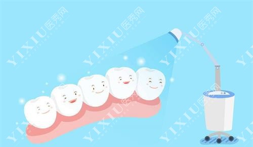 牙齿冷光美白示意图