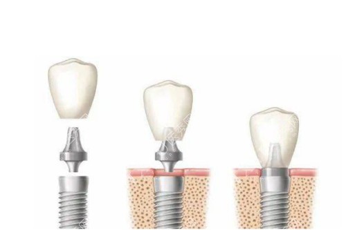 牡丹江看牙哪里比较好？牡丹江张月鹏口腔听说比较可靠是真的吗？(图4)