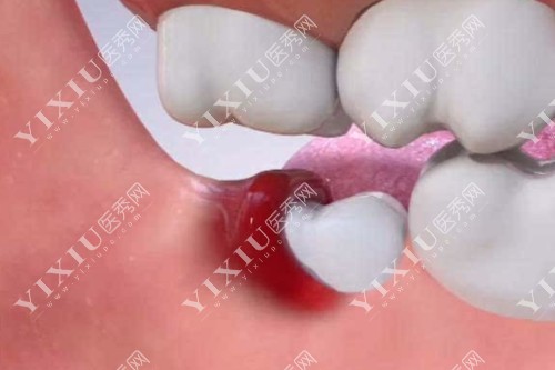 牡丹江看牙哪里比较好？牡丹江张月鹏口腔听说比较可靠是真的吗？(图5)