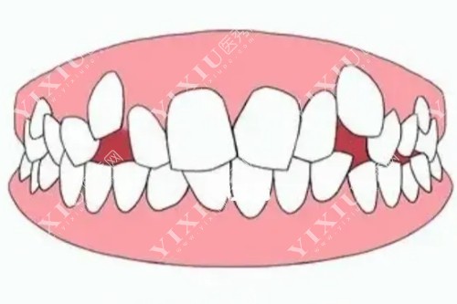 牡丹江看牙哪里比较好？牡丹江张月鹏口腔听说比较可靠是真的吗？(图6)