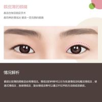 眼皮薄的眼睛手术 塑造完美眼睛 简单而容易-眼皮薄的眼睛-韩国原辰整形外科医院