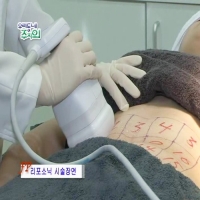 （体型）Liposonix热消脂-瘦身项目-韩国童颜中心医院