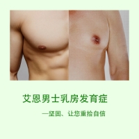 矫正男性乳房发育症——摆脱大胸烦恼-韩国艾恩整形外科